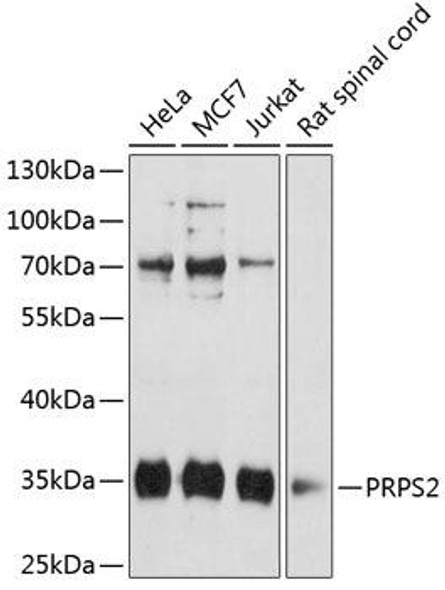 Epigenetics and Nuclear Signaling Antibodies 1 Anti-PRPS2 Antibody CAB12645