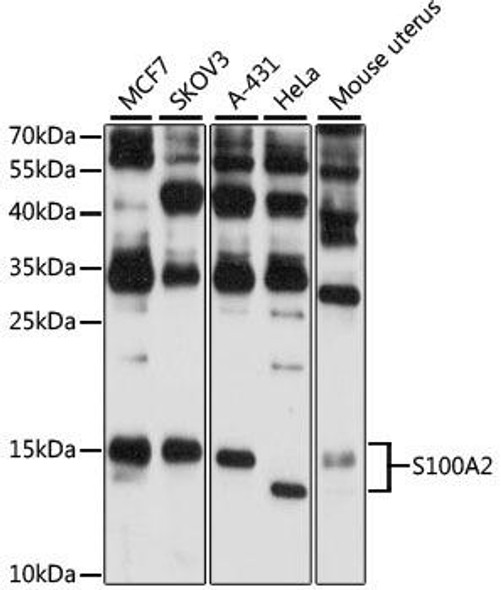 Signal Transduction Antibodies 1 Anti-S100A2 Antibody CAB12647