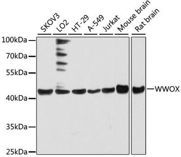 Cell Death Antibodies 1 Anti-WWOX Antibody CAB12653