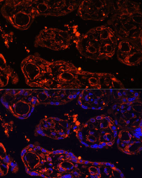 Cell Biology Antibodies 3 Anti-LGR4 Antibody CAB12657