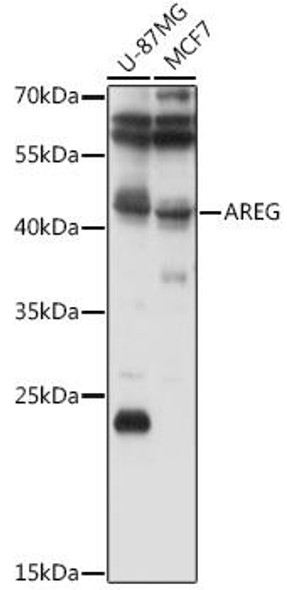 Cell Biology Antibodies 3 Anti-AREG Antibody CAB12680