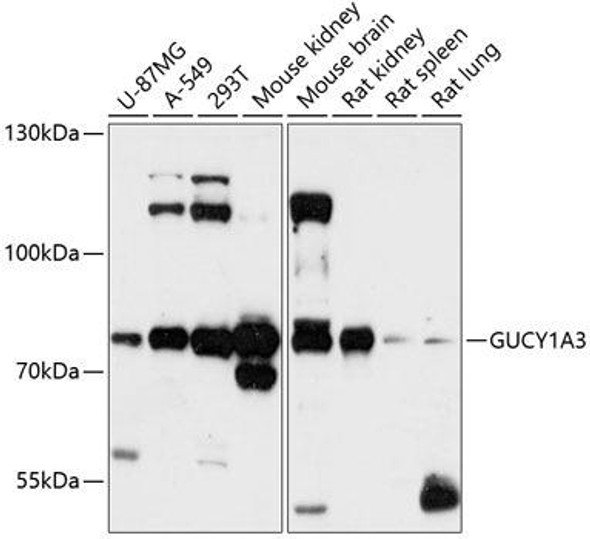 Metabolism Antibodies 1 Anti-GUCY1A3 Antibody CAB12710