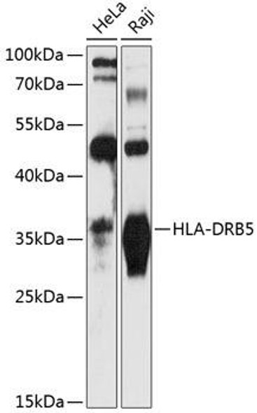 Immunology Antibodies 1 Anti-HLA-DRB5 Antibody CAB12729