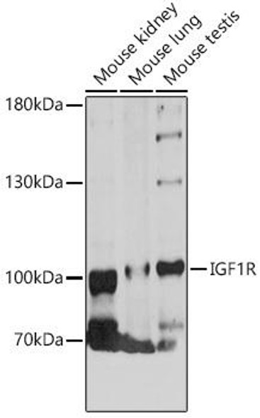 Cell Biology Antibodies 3 Anti-IGF1R Antibody CAB12736