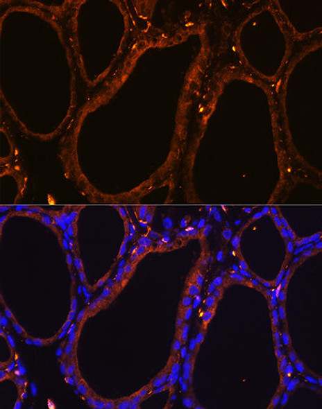 Cell Biology Antibodies 3 Anti-WNT5A Antibody CAB12744