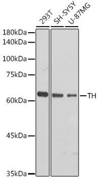 Metabolism Antibodies 1 Anti-TH Antibody CAB12756