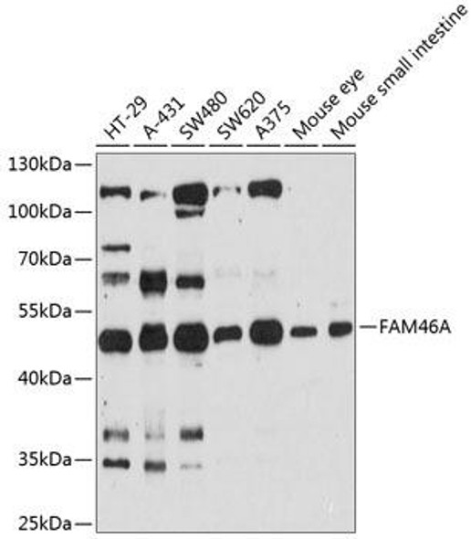 Cell Biology Antibodies 3 Anti-FAM46A Antibody CAB12765