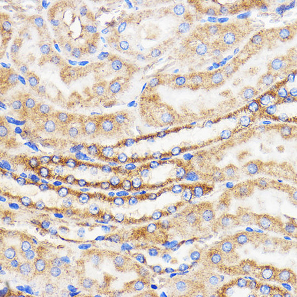 Cell Death Antibodies 1 Anti-Mitofusin 2 Antibody CAB12771