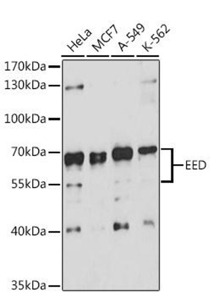 Immunology Antibodies 1 Anti-EED Antibody CAB12773