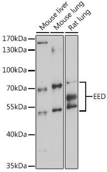 Immunology Antibodies 1 Anti-EED Antibody CAB12773
