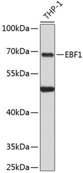 Epigenetics and Nuclear Signaling Antibodies 1 Anti-EBF1 Antibody CAB12782