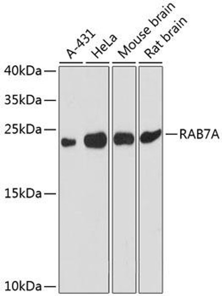 Autophagy Antibodies Anti-RAB7A Antibody CAB12784