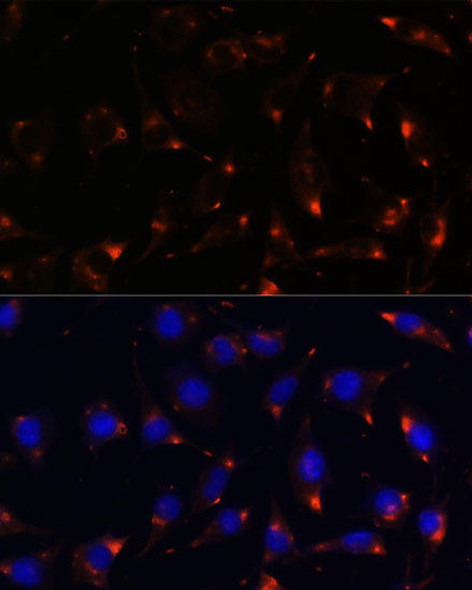 Cell Biology Antibodies 3 Anti-NOS1 Antibody CAB12795