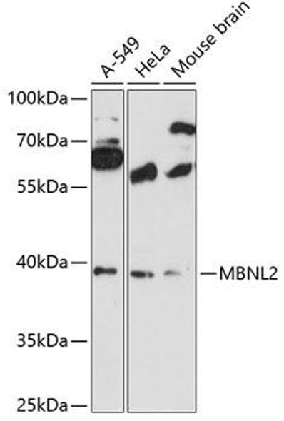 Epigenetics and Nuclear Signaling Antibodies 1 Anti-MBNL2 Antibody CAB12838