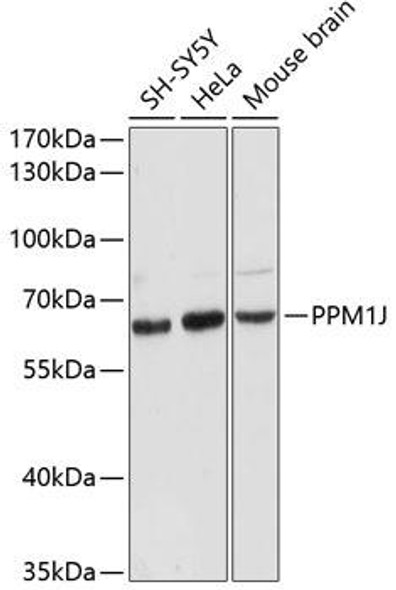 Cell Biology Antibodies 3 Anti-PPM1J Antibody CAB12844