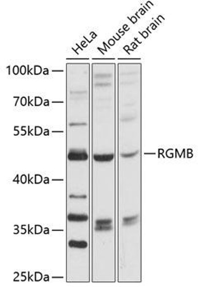 Cell Biology Antibodies 3 Anti-RGMB Antibody CAB12859