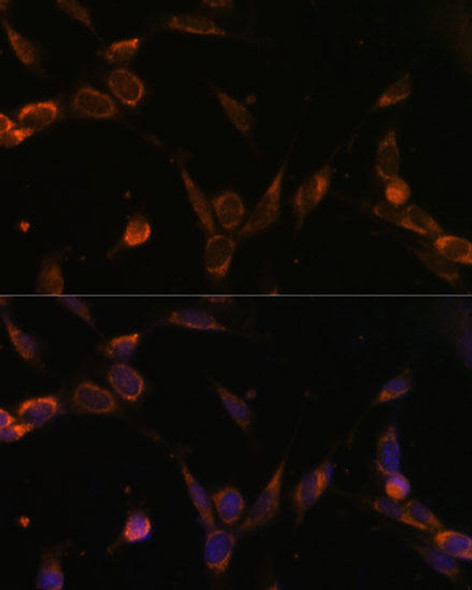 Signal Transduction Antibodies 1 Anti-USP30 Antibody CAB12862