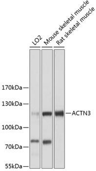 Cell Biology Antibodies 3 Anti-ACTN3 Antibody CAB12864