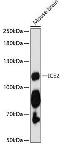 Epigenetics and Nuclear Signaling Antibodies 1 Anti-ICE2 Antibody CAB12871