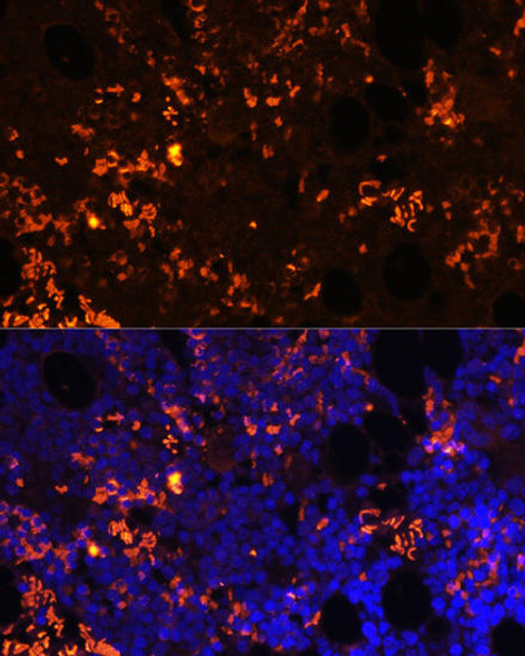 Cell Biology Antibodies 3 Anti-GPR55 Antibody CAB12890