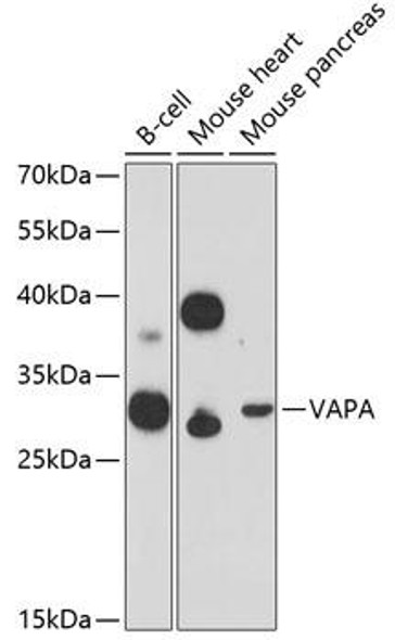 Immunology Antibodies 1 Anti-VAPA Antibody CAB12939