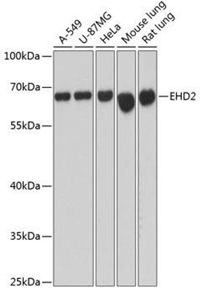 Cell Biology Antibodies 3 Anti-EHD2 Antibody CAB12945