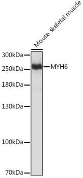 Cell Biology Antibodies 3 Anti-MYH6 Antibody CAB12964