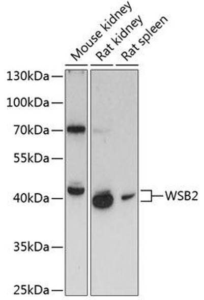 Signal Transduction Antibodies 1 Anti-WSB2 Antibody CAB12970