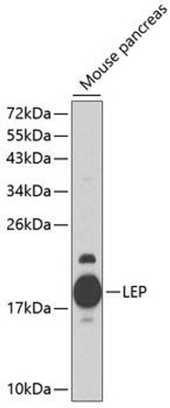 Cell Biology Antibodies 3 Anti-LEP Antibody CAB1300