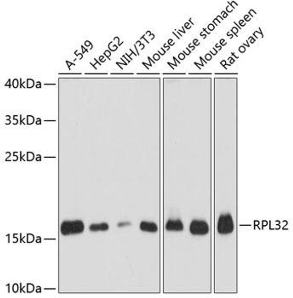 Cell Biology Antibodies 3 Anti-RPL32 Antibody CAB13001