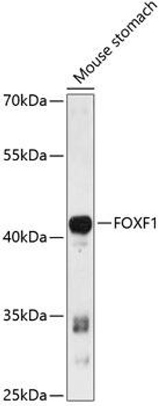 Epigenetics and Nuclear Signaling Antibodies 1 Anti-FOXF1 Antibody CAB13017