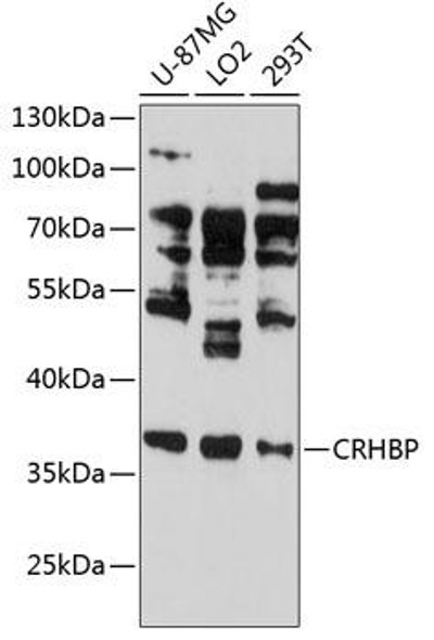 Cell Biology Antibodies 3 Anti-CRHBP Antibody CAB13027