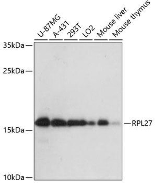 Cell Biology Antibodies 3 Anti-RPL27 Antibody CAB13044