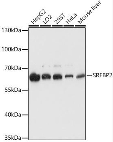 Metabolism Antibodies 1 Anti-SREBP2 Antibody CAB13049