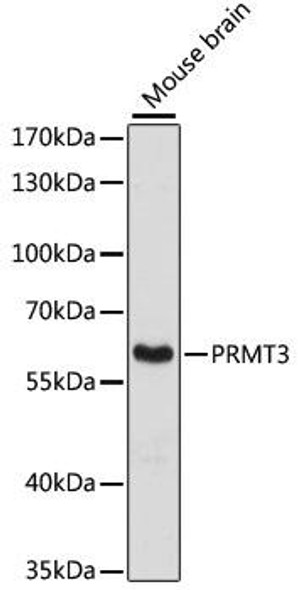 KO Validated Antibodies 1 Anti-PRMT3 Antibody CAB13068KO Validated