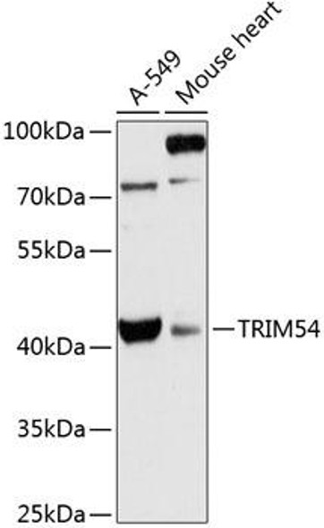 Developmental Biology Anti-TRIM54 Antibody CAB13111