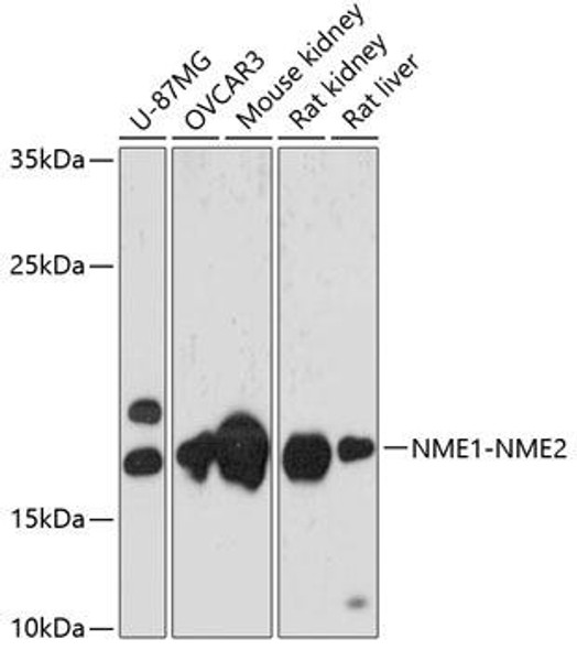 Cell Biology Antibodies 16 Anti-NME1-NME2 Antibody CAB13145