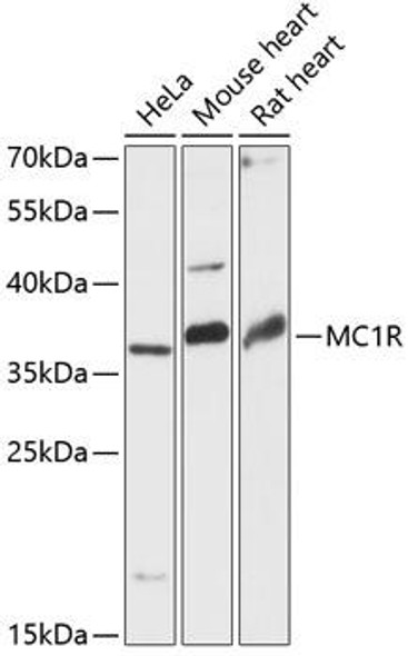 Cell Biology Antibodies 3 Anti-MC1R Antibody CAB13152