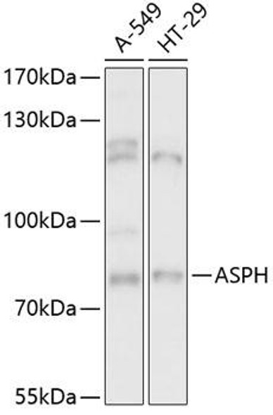 Cell Biology Antibodies 3 Anti-ASPH Antibody CAB13153