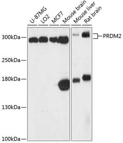 Epigenetics and Nuclear Signaling Antibodies 1 Anti-PRDM2 Antibody CAB13157