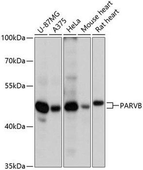 Cell Biology Antibodies 3 Anti-PARVB Antibody CAB13161