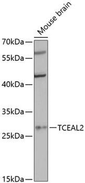 Epigenetics and Nuclear Signaling Antibodies 1 Anti-TCEAL2 Antibody CAB13184