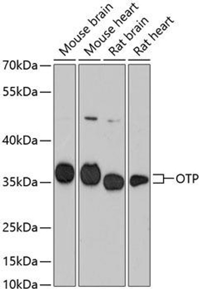 Developmental Biology Anti-OTP Antibody CAB13188