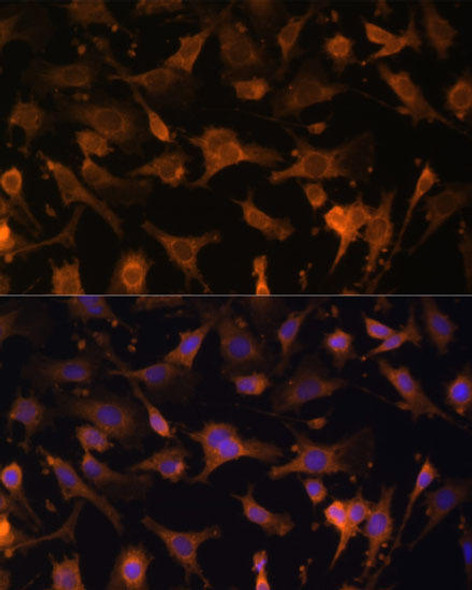 Signal Transduction Antibodies 1 Anti-UFC1 Antibody CAB13192