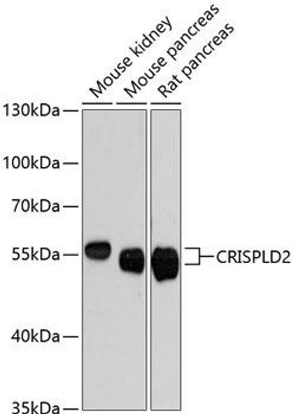 Signal Transduction Antibodies 1 Anti-CRISPLD2 Antibody CAB13195