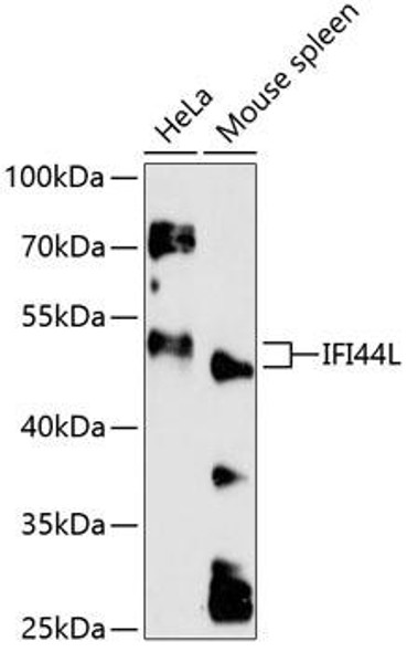 Immunology Antibodies 1 Anti-IFI44L Antibody CAB13210