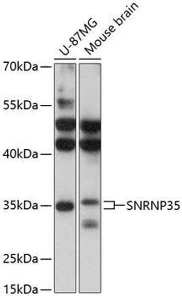 Epigenetics and Nuclear Signaling Antibodies 1 Anti-SNRNP35 Antibody CAB13211