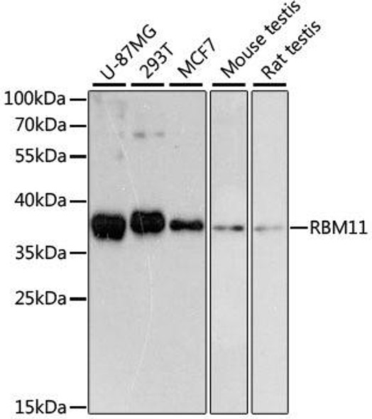 Developmental Biology Anti-RBM11 Antibody CAB13216