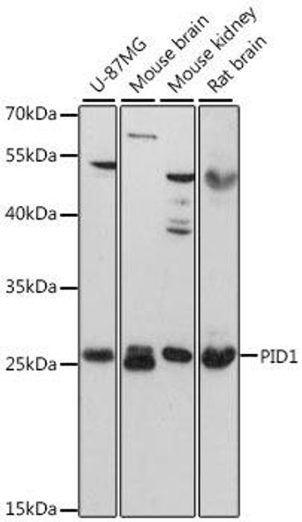 Signal Transduction Antibodies 1 Anti-PID1 Antibody CAB13220