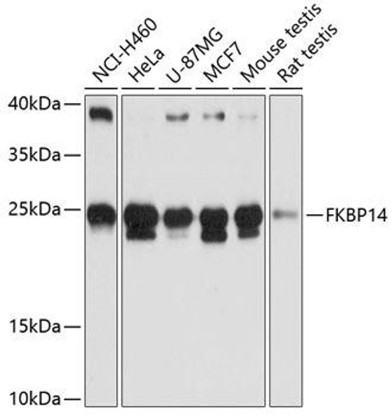 Cell Biology Antibodies 3 Anti-FKBP14 Antibody CAB13221